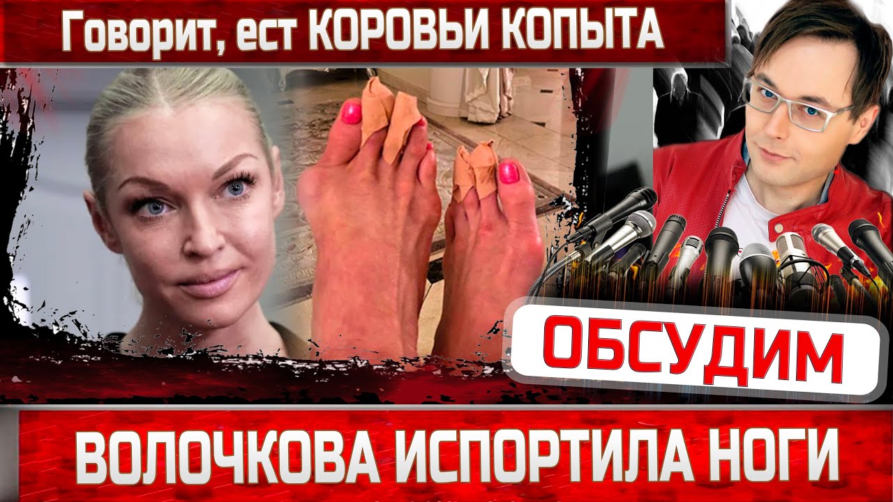 Анастасия Волочкова лечит ноги. Говорит, помогают коровьи копыта ...