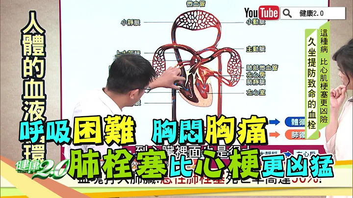 呼吸困難、胸悶胸痛！肺栓塞比心梗更兇猛！ - 天天要聞