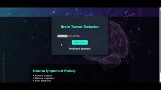 Brain Tumor Detection: PyTorch, CNN