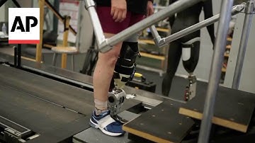 New technology helps amputees walk with natural gait