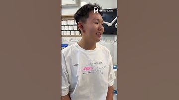 Niềng răng chen chúc và điều trị hết viêm nướu nhờ khay trong suốt #nhakhoatuongminh