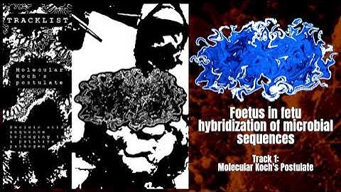 Aggregatibacter Actinomycetemcomitans - Foetus in Fetu... [Album] (Cellwall)