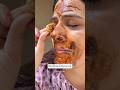 Blackheads/Whiteheads &amp; Dead skin Remover in 1 Day, Get Glass Skin #beauty #skincare #glowingskin