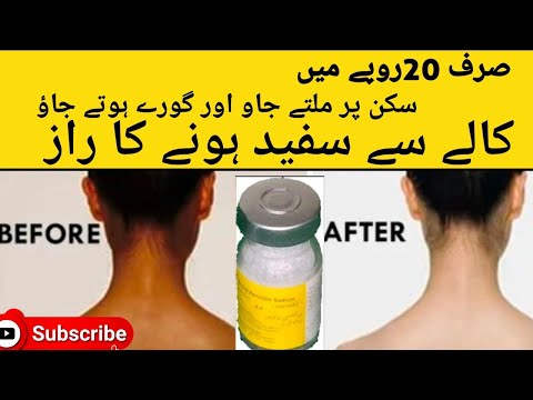 Quick & Fast Treatment Acne Pimple Removal On Face | Quick & Fast Treatment Acne Pimple Removal On Face |