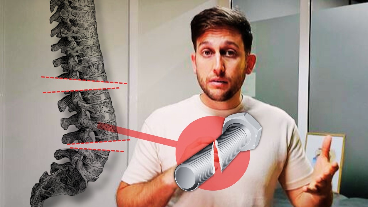 Síntomas de ROTURA de Operación LUMBAR | CIRUGÍA