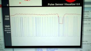 Pulsesensor On Cc2540