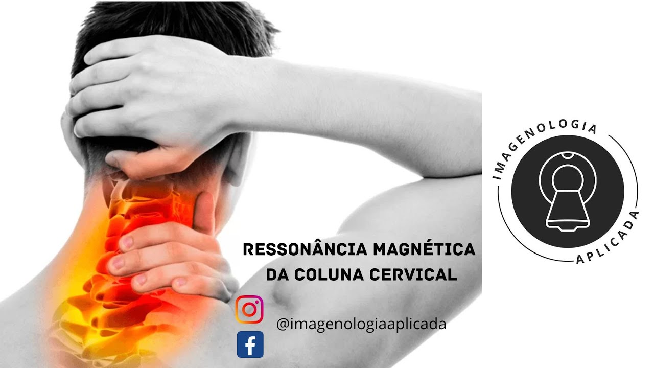 Ressonância Magnética da Coluna Cervical