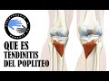 Tendinitis poplitea, que es y porque se produce el dolor detras de la rodilla