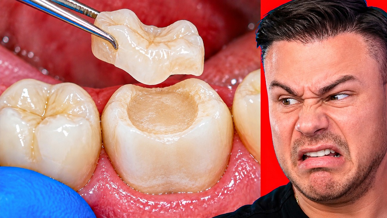 Is This ASMR Tooth Restoration Real??