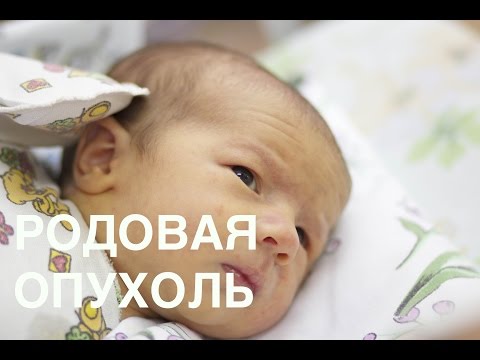Родовая опухоль и формы черепа - Часть 1 || ОВП