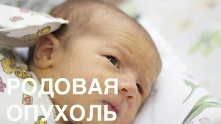 Родовая опухоль и формы черепа - Часть 1 || ОВП