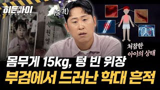 Download lagu [평택 아동 암매장 사건②] 한 달 전 이미 숨진 8살 아들… 부검 결과 드러난 학대의 흔적 l #히든아이 l #MBCevery1 l EP.103