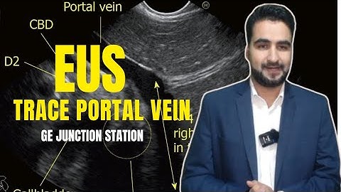Tracing the Portal Vein and Its Branches from Station 1 | EUS Liver Anatomy Tutorial