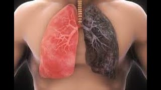 التدخين و أضراره على الجهاز التنفسي