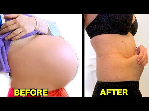 Video: The Model Showed Cellulite And Stretch Marks On The Body After Childbirth And Was Known As A Slob