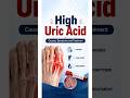 🔥High Uric Acid Explained: Causes, Symptoms & Treatment |