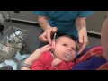 Hearing test  infant hearing screening