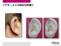 耳かけ型補聴器とイヤモールド