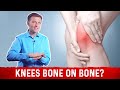 Knee Osteoarthritis: Bone On Bone Knee Pain Relief Treatment By Dr.Berg