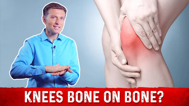 Knee Osteoarthritis: Bone On Bone Knee Pain Relief Treatment By Dr.Berg