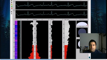 Arduino ECG Shield Demo
