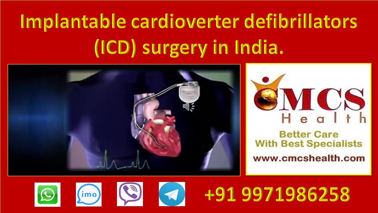 ICD Implant surgery in India with best Indian Cardiologists CMCS