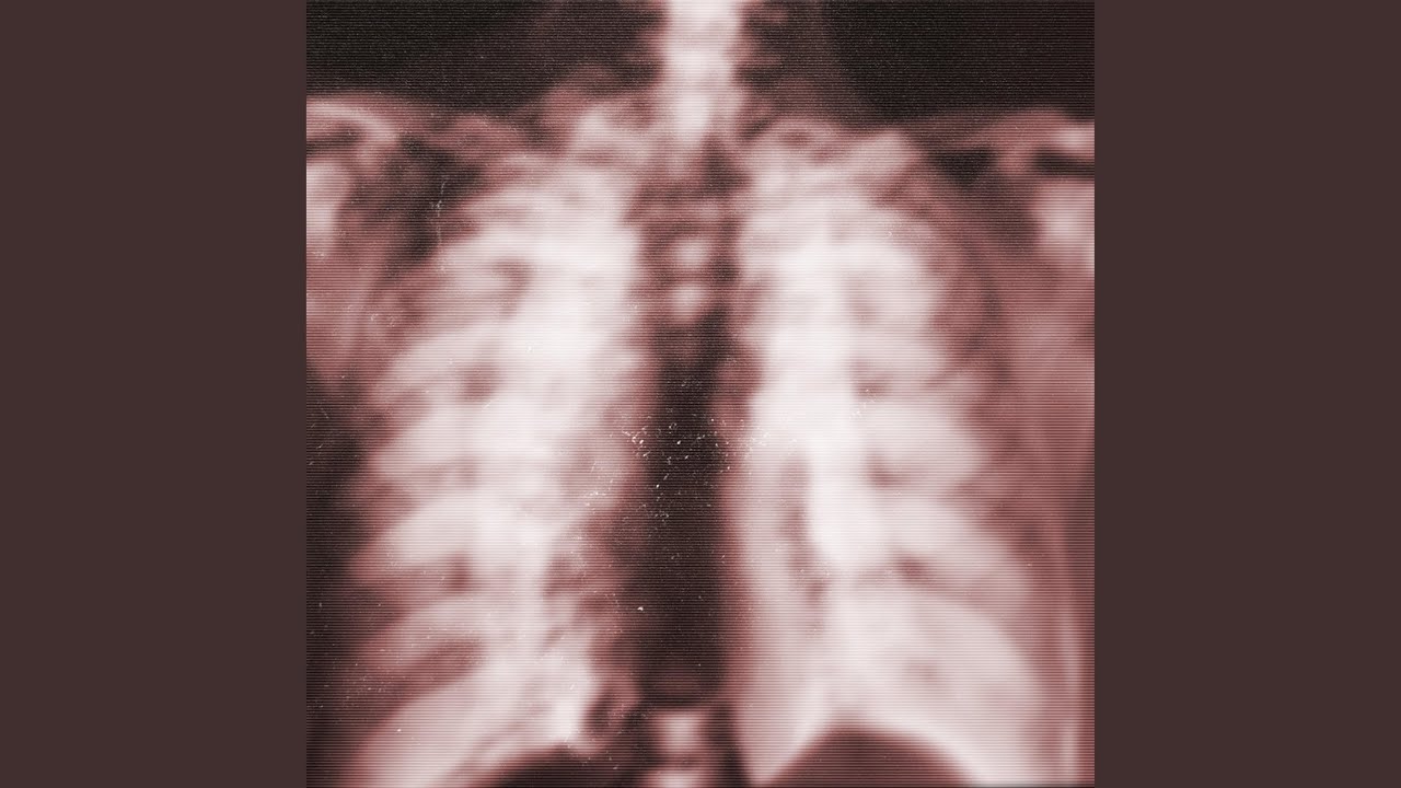 Watch crush on YouTube Watch crush on YouTube