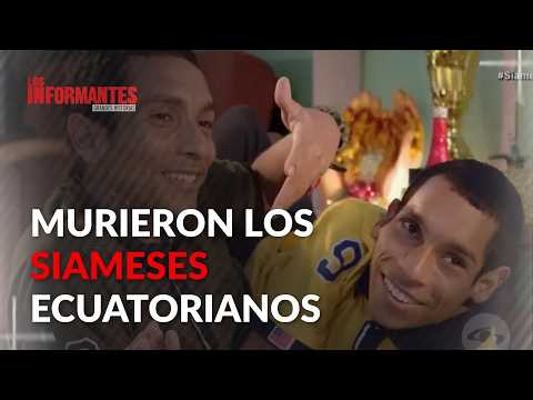 Ecuadorian conjoined twins pass away at 27 against all odds