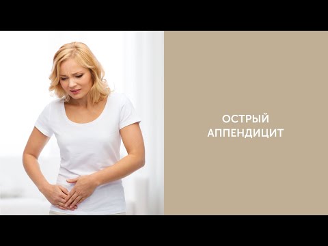 Острый аппендицит