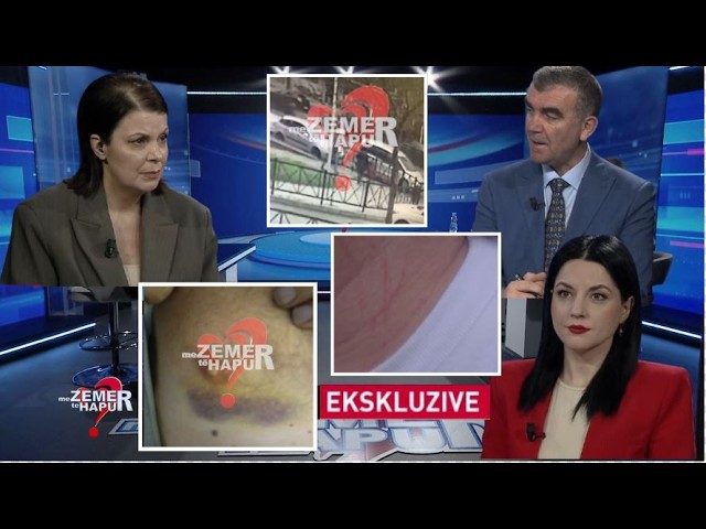 EKSKLUZIVE/ Pamje tronditëse! Sulmi ndaj 42-vjeçares kapet në video, panik para fëmijës