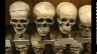 The Creepiest Museum On Earth!! The Mutter Museum Documentary