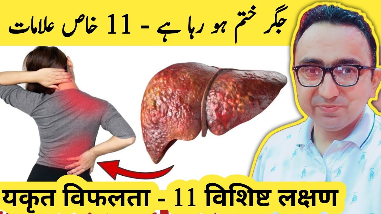 LIVER Is DYING! 11 Weird Signs of Liver Damage