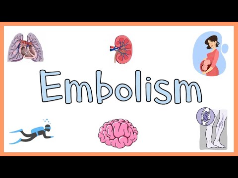 Embolism : Definition, Types of Embolism & Clinical Manifestations