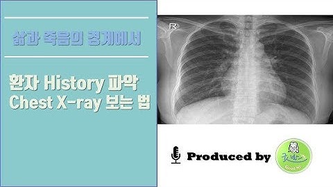 chest X ray 보는법 & pulmonary edema