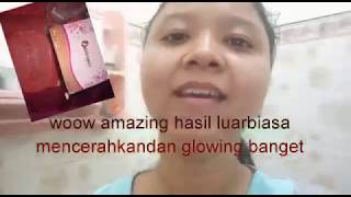 viral!!!part 2 /hasil dari memakai klinskin beauty soap
