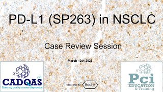 CADQAS Proficiency Test Case Review Session for PT 623 (PD-L1 (SP263) IHC in NSCLC)