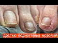 ПЕДИКЮР😎КАК РАСПОЗНАТЬ НЕЛАДНОЕ 🤨