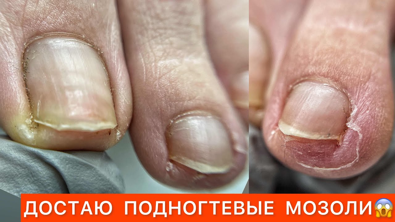 ПЕДИКЮР😎КАК РАСПОЗНАТЬ НЕЛАДНОЕ 🤨