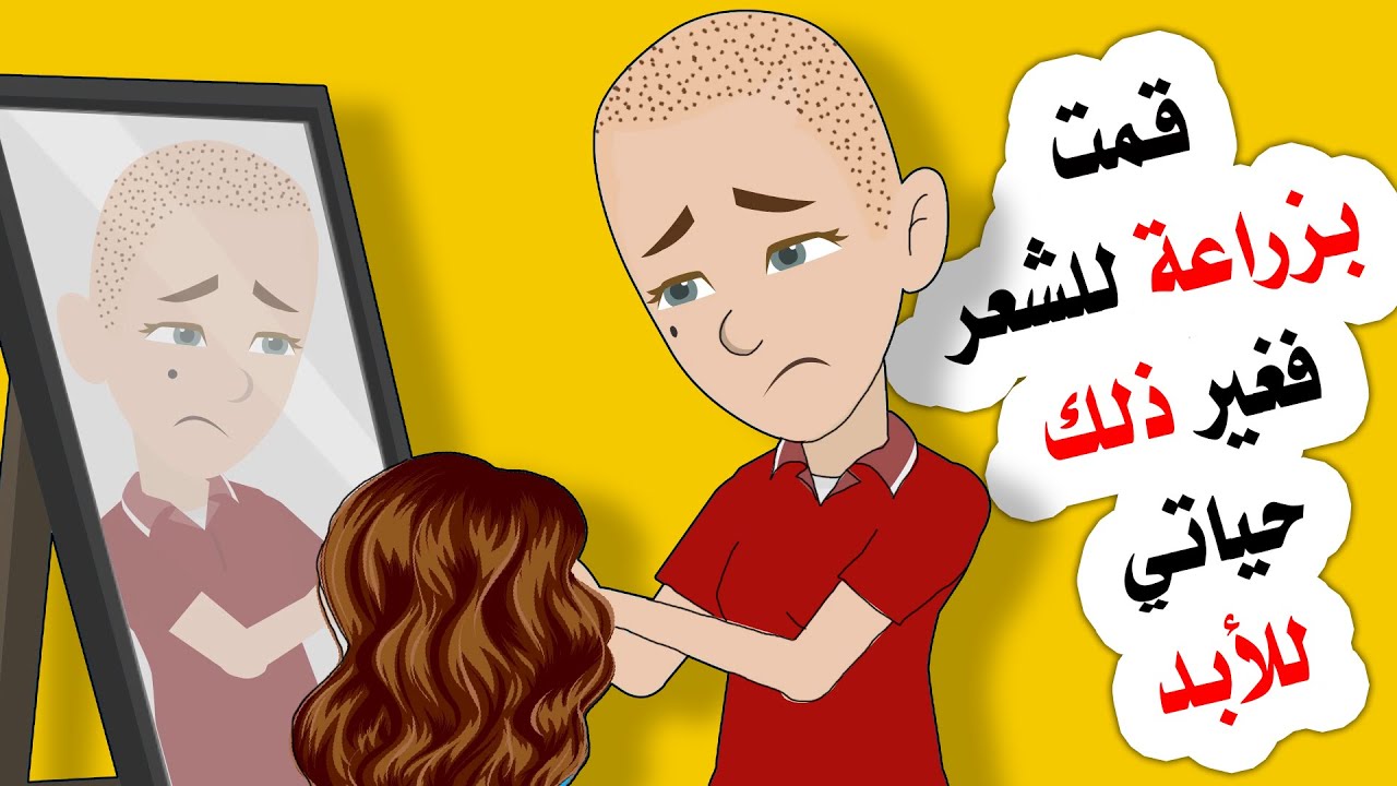 قمت بزراعة للشعر فغير ذلك حياتي للأبد