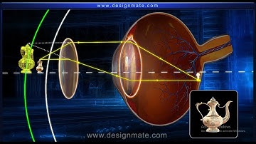 Defects of Vision and their Correction