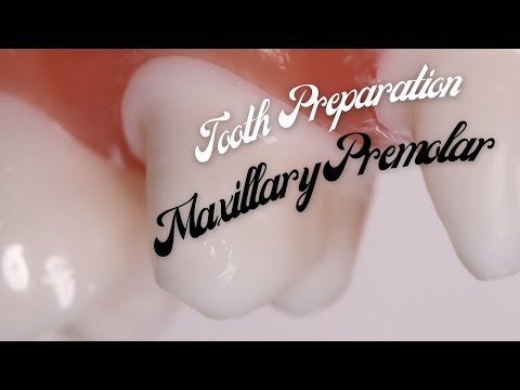Tooth Preparation for PFM 🔵 Maxillary First Premolar 🟡 Step by Step Demonstration