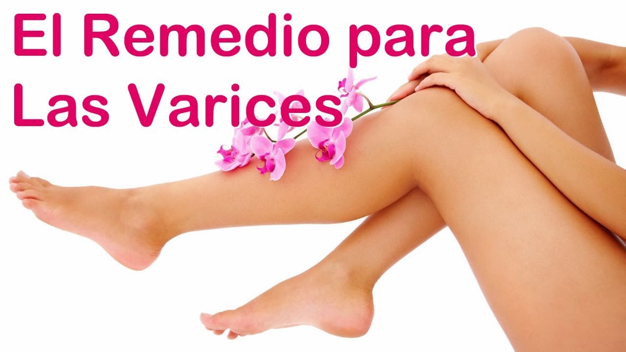 remedios naturales para la artritis Olvídate de las VARICES, toma esto diariamente, y ve cómo se irán en poco tiempo.