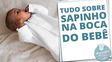 O que cura sapinho na boca de bebê?