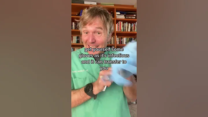 Cat Hair Loss could be Ringworm- this OTC remedy works well!