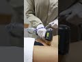 Depila&ccedil;&atilde;o &agrave; Laser na Virilha