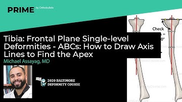 Tibia: Frontal Plane Single-level Deformities - ABCs - Michael Assayag, MD