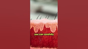 How to remove a staple from your finger? 🤔 #shorts #facts