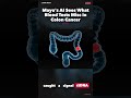 Mayo's AI Sees What Blood Tests Miss in Colon Cancer #Shorts