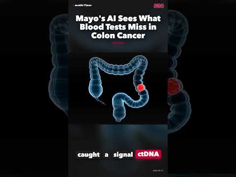 Mayo's AI Sees What Blood Tests Miss in Colon Cancer #Shorts