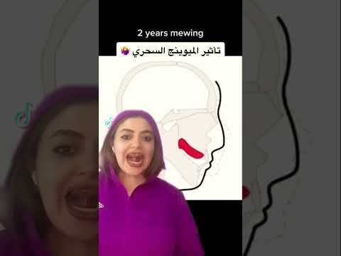 فيديو: 3 طرق للحصول على لسان صحي